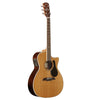Alvarez AG75WCE ARTIST